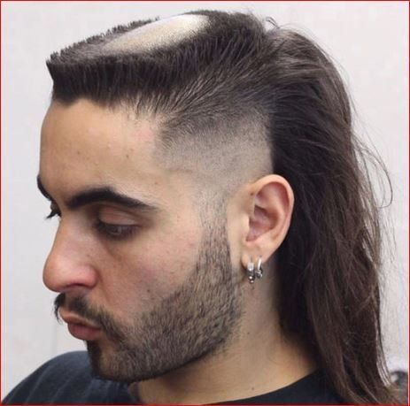 Bald or shaven on top Mullet